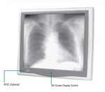 ONYX 195STT-A1-101 C2D T7200/2/SSD240/W